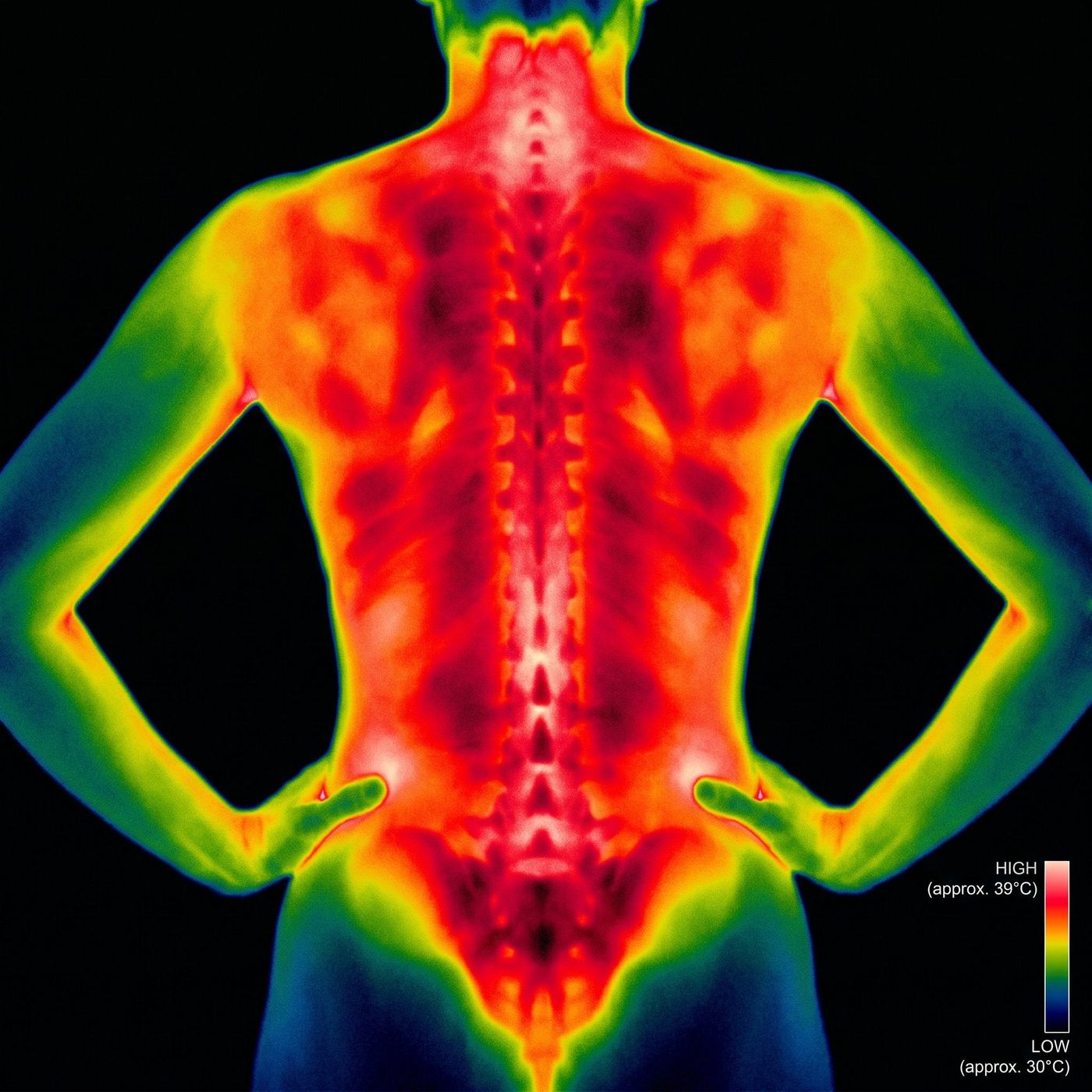 Thermal scan before treatment